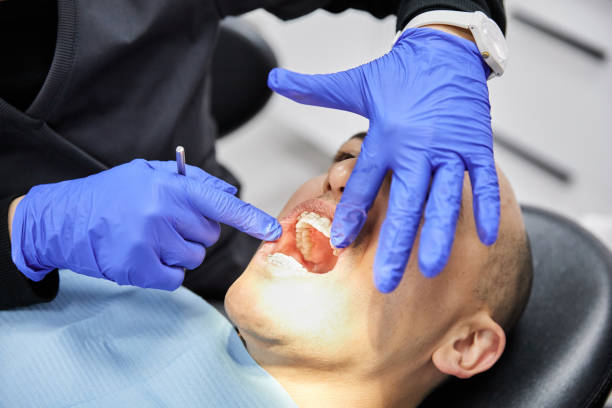 Best Broken or Cracked Tooth Emergency Dentist in Avon Lake, OH