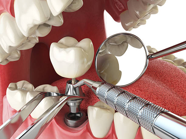 Best Mobile Emergency Dentist in Avon Lake, OH